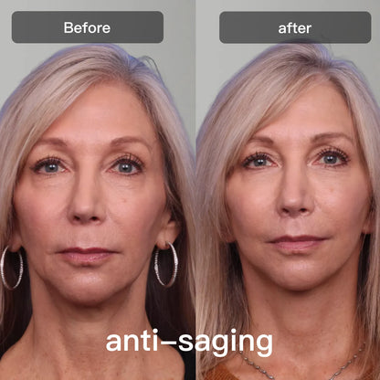 Prime LED-lysterapienhet