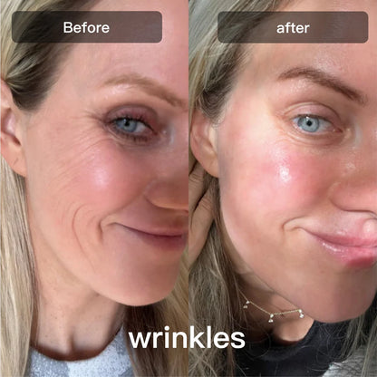 Prime LED-lysterapienhet