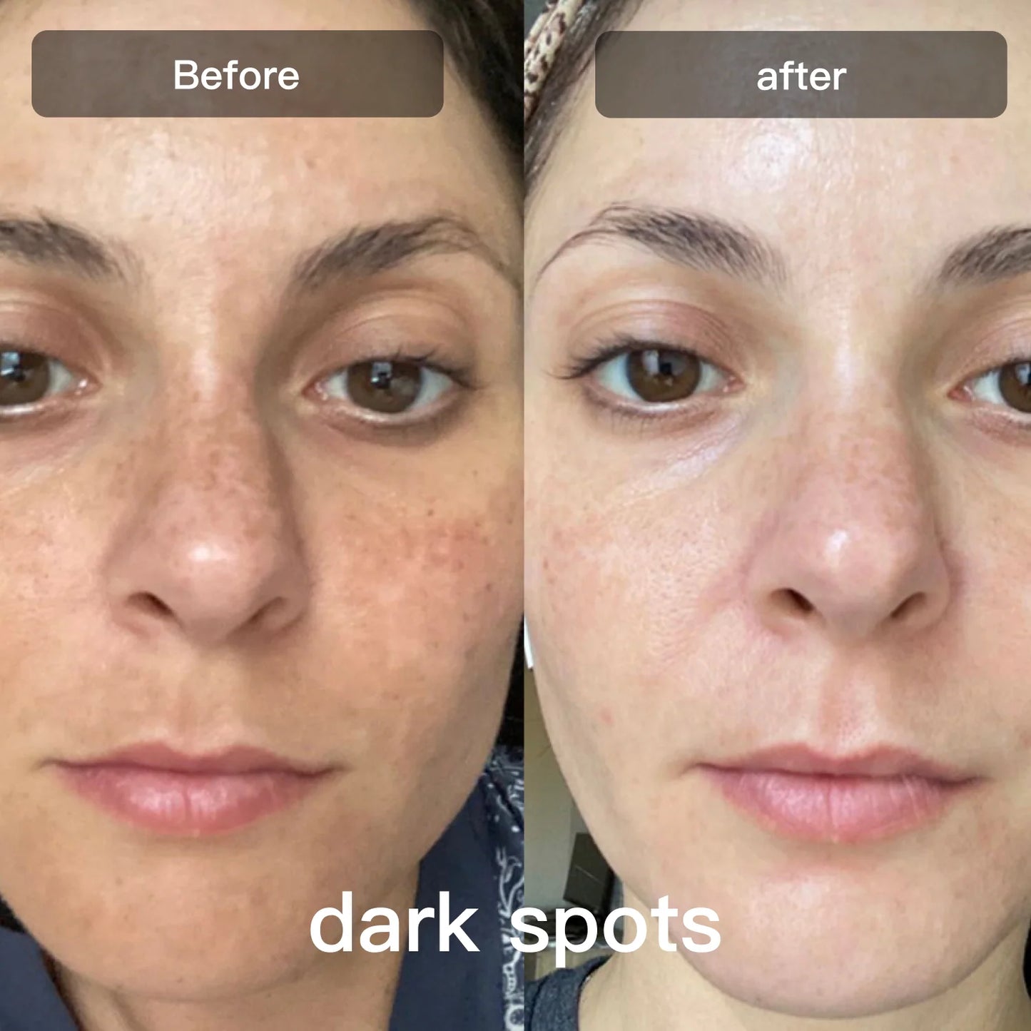 Prime LED-lysterapienhet