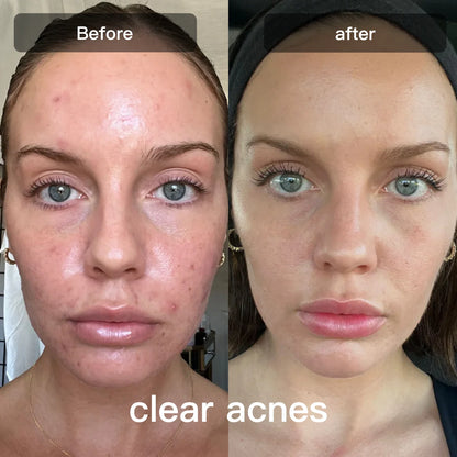 Prime LED-lysterapienhet